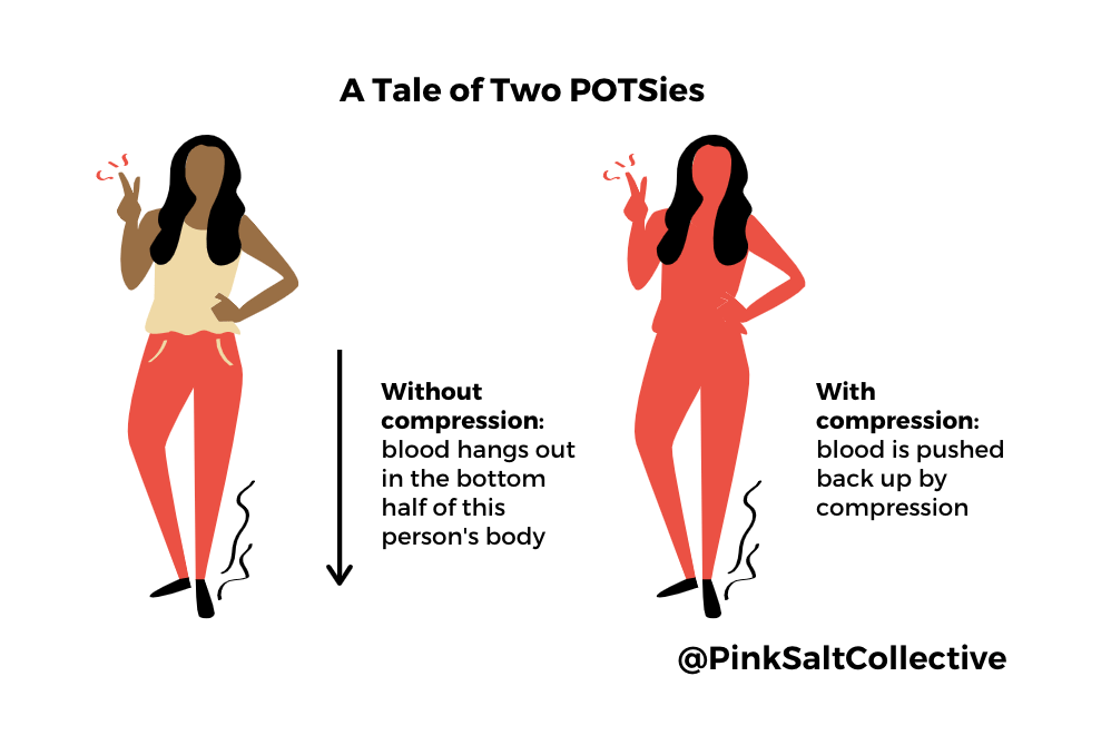 POTS Compression- two people showing the impact of blood pooling without and with compression